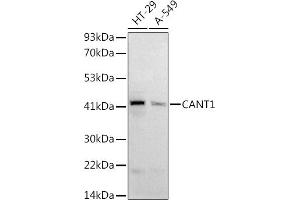 Western blot analysis of extracts of various cell lines, using (ABIN6128977, ABIN6137904, ABIN6137907 and ABIN6221957) at 1:1000 dilution. (CANT1 抗体  (AA 102-401))