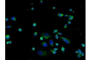 Image provided by One World Lab validation initiative. (LAMP1 抗体  (AA 301-417))