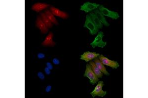ABIN6257708 and ABIN6275404 staining Hela cells by IF/ICC. (FNTB 抗体  (Internal Region))