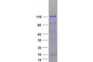 Validation with Western Blot