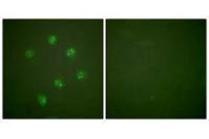 Immunofluorescence analysis of COS7 cells, using Ki67antibody. (Ki-67 抗体  (C-Term))