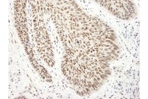 Immunohistochemistry (IHC) image for anti-Ewing Sarcoma Breakpoint Region 1 (EWSR1) (AA 100-150) antibody (ABIN7448557)