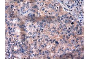 Image no. 2 for anti-Keratin 18 (KRT18) (AA 69-372) antibody (ABIN1491639) (Cytokeratin 18 抗体  (AA 69-372))