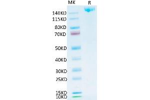 SARS-COV-2 Spike S Trimer on Tris-Bis PAGE under reduced condition.