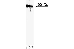Western Blotting (WB) image for anti-Ribosomal Protein S6 Kinase, 90kDa, Polypeptide 1 (RPS6KA1) (AA 1-184) antibody (ABIN967838) (RPS6KA1 抗体  (AA 1-184))