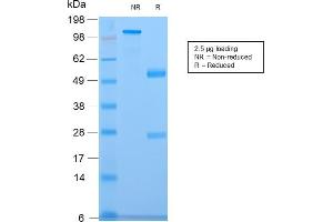 SDS-PAGE Analysis of Purified CELA3B Rabbit Recombinant Monoclonal Antibody (CELA3B/2809R). (Recombinant Elastase 3B 抗体  (AA 82-238))