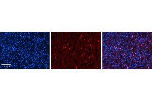 Immunohistochemistry (IHC) image for anti-Cytochrome P450, Family 3, Subfamily A, Polypeptide 4 (CYP3A4) (Middle Region) antibody (ABIN2783885) (CYP3A4 抗体  (Middle Region))