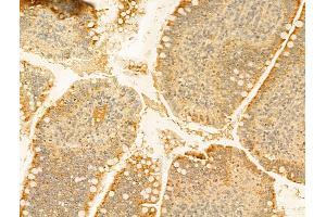 ABIN6255185 and ABIN6267483 at 1/100 staining Rat colon tissue by IHC-P.