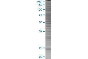 HSPB8 transfected lysate. (HSPB8 293T Cell Transient Overexpression Lysate(Denatured))