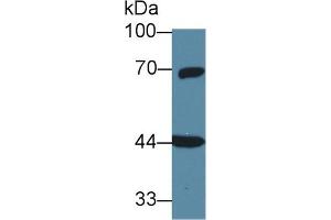 Western Blot; Sample: Rat Cerebrum lysate; Primary Ab: 1µg/ml Rabbit Anti-Human GNa11 Antibody Second Ab: 0. (GNA11 抗体  (AA 1-359))