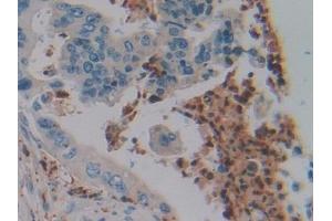 Immunohistochemistry (IHC) image for anti-Defensin, alpha 4, Corticostatin (DEFA4) (AA 23-97) antibody (ABIN7441130)