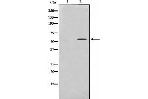 Western blot analysis on HeLa cell lysate using Cytochrome P450 2U1 Antibody，The lane on the left is treated with the antigen-specific peptide. (CYP2U1 抗体  (Internal Region))