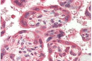 anti-NLR Family, Apoptosis Inhibitory Protein (NAIP) (C-Term) antibody