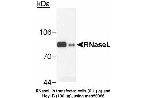 Image no. 2 for anti-Ribonuclease L (2',5'-Oligoisoadenylate Synthetase-Dependent) (RNASEL) antibody (ABIN363220) (RNASEL 抗体)
