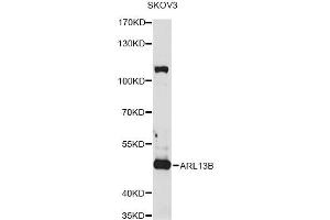 Western blot analysis of extracts of SKOV3 cells, using ARL13B antibody (ABIN1876411) at 1:1000 dilution.