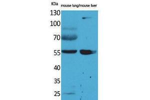 Western Blotting (WB) image for anti-Aldehyde Dehydrogenase 1 Family, Member A1 (ALDH1A1) (N-Term) antibody (ABIN3178188) (ALDH1A1 抗体  (N-Term))
