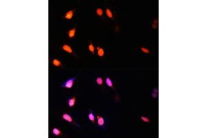 Immunofluorescence (IF) image for anti-SET Domain Containing 2 (SETD2) (AA 803-1103) antibody (ABIN1682666)