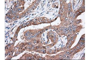 Immunohistochemical staining of paraffin-embedded Human Kidney tissue using anti-TTC32 mouse monoclonal antibody. (TTC32 抗体)