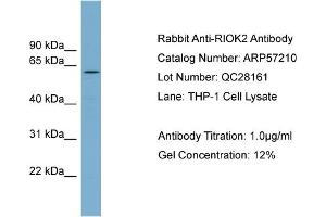 WB Suggested Anti-RIOK2  Antibody Titration: 0. (RIOK2 抗体  (Middle Region))