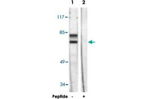 Western blot analysis of extracts from HeLa cells, using LMNA polyclonal antibody . (Lamin A/C 抗体)