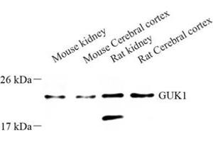 Western blot analysis of GUK1 (ABIN7074153) at dilution of 1: 500 (GUK1 抗体)