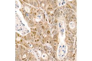 Immunohistochemistry (IHC) image for anti-Tubulin, alpha 4a (TUBA4A) antibody (ABIN7271036)