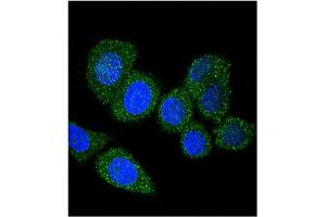 Image no. 3 for anti-Acyl-CoA Synthetase Long-Chain Family Member 4 (ACSL4) (AA 244-274) antibody (ABIN357780) (ACSL4 抗体  (AA 244-274))
