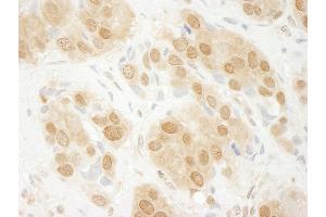 Immunohistochemistry (IHC) image for anti-Mitogen-Activated Protein Kinase 3 (MAPK3) (AA 329-379) antibody (ABIN7453702) (ERK1 抗体  (AA 329-379))