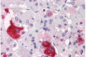 Immunohistochemistry (IHC) image for anti-Corticotropin Releasing Hormone Receptor 2 (CRHR2) (N-Term) antibody (ABIN1048464)