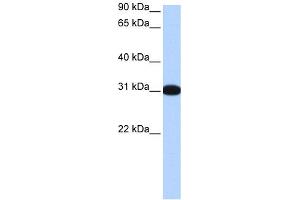 WB Suggested Anti-MBNL2 Antibody Titration:  0. (MBNL2 抗体  (Middle Region))