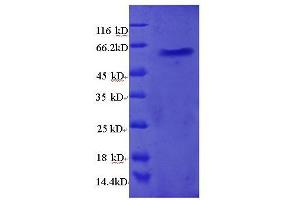 SDS-PAGE (SDS) image for Ribosomal Protein L5 (RPL5) (AA 2-297), (full length) protein (GST tag) (ABIN7479215)