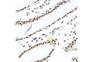 Immunohistochemistry of paraffin-embedded human stomach using SSB antibody at dilution of 1:100 (40x lens). (SSB 抗体)