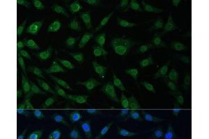 Immunofluorescence analysis of L929 cells using NUP214 Polyclonal Antibody at dilution of 1:100 (40x lens). (NUP214 抗体)