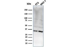 Western Blot Analysis of PC3 and MCF-7 cell lysate using NKX2. (NKX2-8 抗体  (AA 10-123))