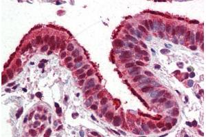 Human Lung, Respiratory Epithelium (formalin-fixed, paraffin-embedded) stained with FOXP1 antibody ABIN364260 at 10 ug/ml followed by biotinylated anti-mouse IgG secondary antibody ABIN481714, alkaline phosphatase-streptavidin and chromogen. (FOXP1 抗体)