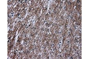 Immunohistochemical staining of paraffin-embedded liver tissue using anti-FAHD2A mouse monoclonal antibody. (FAHD2A 抗体)