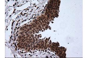 Image no. 3 for anti-Rhotekin (RTKN) antibody (ABIN1500702)