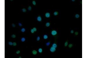 Detection of CIRBP in Human HepG2 cell using Polyclonal Antibody to Cold Inducible RNA Binding Protein (CIRBP) (CIRBP 抗体  (AA 1-172))