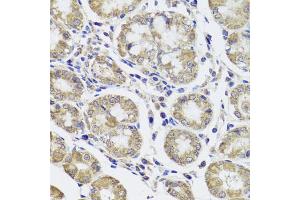 Immunohistochemistry of paraffin-embedded human stomach using CTSC antibody (ABIN5974676) at dilution of 1/100 (40x lens). (CTSC 抗体)