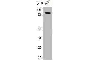Western Blot analysis of HeLa cells using Catenin-β1 Polyclonal Antibody