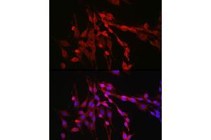 Immunofluorescence analysis of PC-12 cells using Inhibin beta A (INHBA) Rabbit pAb (ABIN6129032, ABIN6142459, ABIN6142460 and ABIN6221533) at dilution of 1:50 (40x lens). (INHBA 抗体  (AA 21-426))