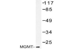 Western blot (WB) analysis of MGMT antibody in extracts from Jurkat cells. (MGMT 抗体)