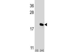 Western blot analysis of IL-17 antibody and 293 cell lysate (2 ug/lane) either nontransfected (Lane 1) or transiently transfected (2) with the IL17A gene. (Interleukin 17a 抗体  (AA 61-87))