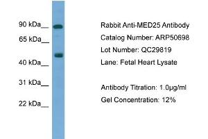 WB Suggested Anti-MED25  Antibody Titration: 0. (MED25 抗体  (N-Term))