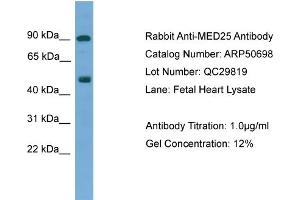 WB Suggested Anti-MED25  Antibody Titration: 0.