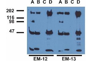 Immunoprecipitation ofEGFR from EGF-treated A431 cells by monoclonal antibodies (A), EM-13 (B), a commercial anti-EGFR polyclonal antibody (C)and anti-EGFR monoclonal mAb108 (D). (EGFR 抗体  (pTyr992))