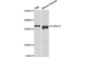 Western blot analysis of extracts of various cell lines, using CARD11 antibody (ABIN5974295) at 1/1000 dilution. (CARD11 抗体)