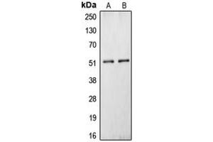 Western blot analysis of Carboxypeptidase N 1 expression in HepG2 (A), HEK293T (B) whole cell lysates. (CPN1 抗体  (C-Term))
