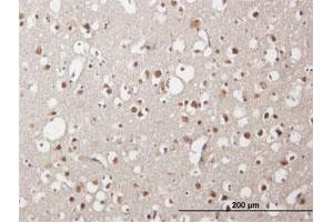 Immunohistochemistry (Formalin-fixed Paraffin-embedded Sections) (IHC (fp)) image for anti-Zinc Finger Protein 483 (ZNF483) (AA 1-244) antibody (ABIN531092)