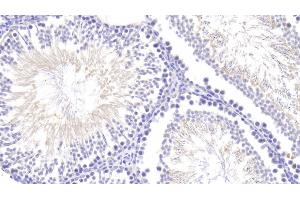Detection of ANG in Rat Testis Tissue using Polyclonal Antibody to Angiogenin (ANG) (ANG 抗体  (AA 25-142))